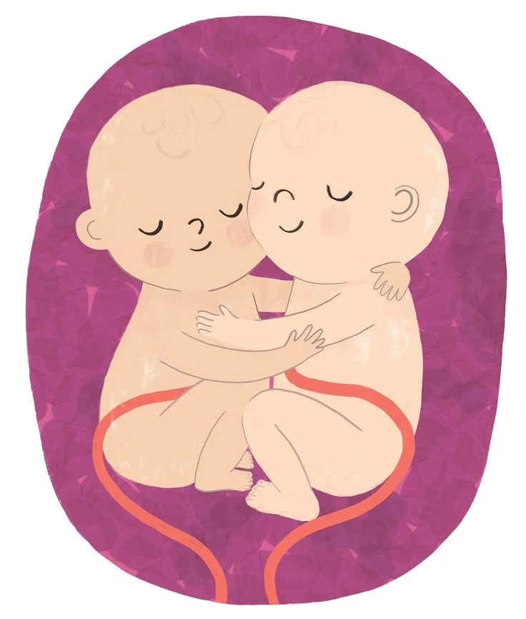 İkiz Bebek Bakımında Organizasyon